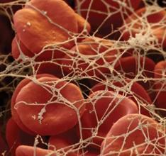 Qu'est-ce que le fibrinogène dans le sang: la norme et les causes de l'augmentation