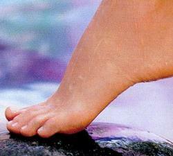 Eczema ai piedi