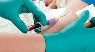 biokjemisk blodprøve