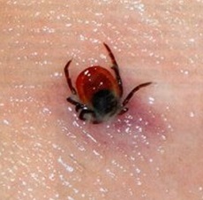 The tick of a person