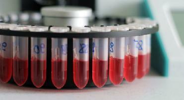trascrizione di analisi del sangue generale