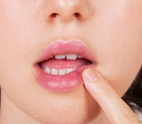 l'herpès sur les symptômes de la lèvre