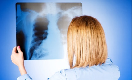 Lunginflammation - symptom hos vuxna, behandling och konsekvenser