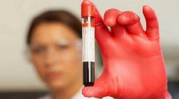 kaj je biokemijski test krvi