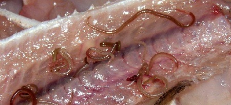 Worms - tünetek és kezelés egy felnőttnél