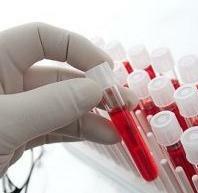 How is a biochemical blood test performed