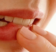 tandkødsbetændelse