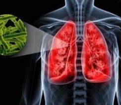 Tuberculose van de longen