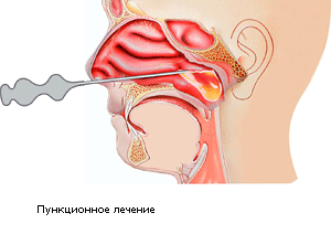 Šupljina sinusnog sinusa