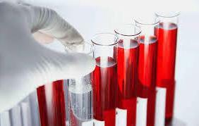 sečna kislina v krvi